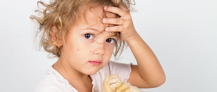 Boutons de rougeole chez l’enfant